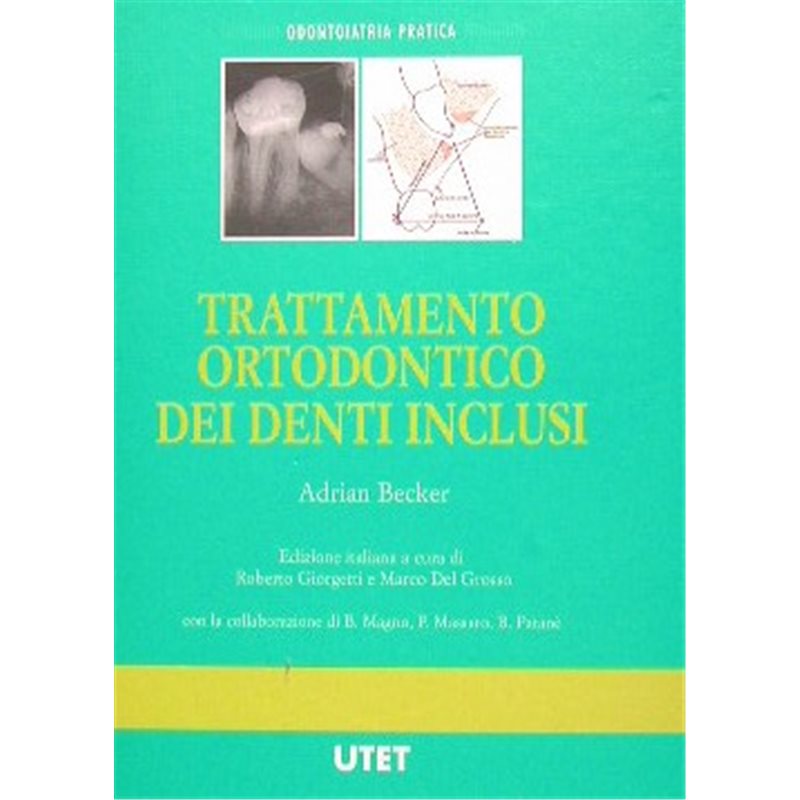 Trattamento ortodontico dei denti inclusi